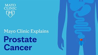 Mayo Clinic Explains Prostate Cancer [upl. by Lyn]