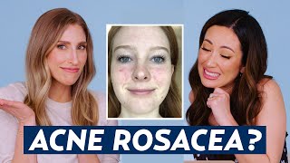 Can You Have Acne AND Rosacea Dermatologist Reacts to Danas Skincare Routine  DERM REACTS [upl. by Okiman448]