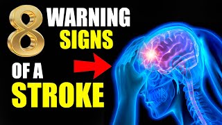 What Are the 8 Warning Signs of a Stroke [upl. by Weinrich]