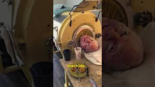 The Man Who Lived 70 Years in an Iron Lung [upl. by Gaudette295]