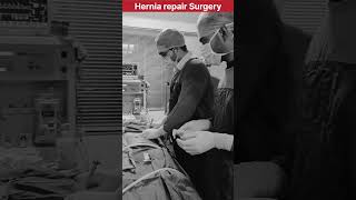 Hernia Repair Surgery Laparoscopic Mesh Hernioplasty Surgery herniatreatment doctor mbbs [upl. by Lebiralc]