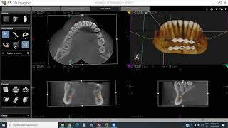 CS3D Carestream Manejo de software de Tomografía Cone Beam Dr Enrique Sierra Rosales [upl. by Dino509]