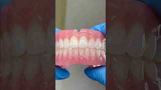 Incredible Immediate Dentures lsk121shorts dentist teeth [upl. by Limbert]