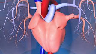 Implantable CardioverterDefibrillator ICD [upl. by Anesor]