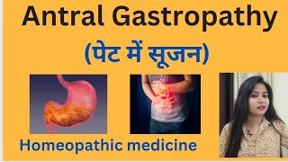 Antral Gastropathy पेट में सूजन treatment  Antral gastritis symptomscause amp homeopathic medicine [upl. by Hugibert]