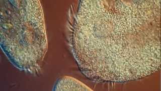 One Drop of Water Amazing High Definition Microscopy Video 1080P [upl. by Isabelle255]