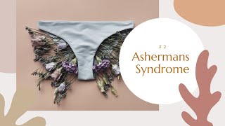 I had Ashermans Syndrome and now its gone [upl. by Mcconnell]