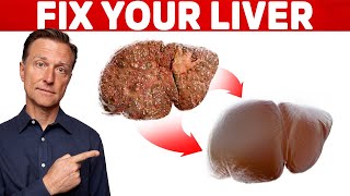 The 6 Best Ways to Heal a Fatty Liver [upl. by Barabas]