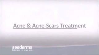 Mediderma Acne amp Acne Scar Treatment On ClickOnCare [upl. by Leesa]