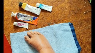 Heilende Salben bei Entzündungen Retterspitz Voltaren Schmerzgel Forte Traumaplant Bebanthen [upl. by Soane]