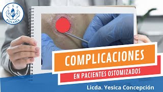 COMPLICACIONES EN PACIENTES CON OSTOMÍAS [upl. by Christan]