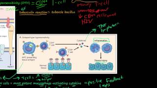 81P DelayedType Hypersensitivity TCellMediated Type IV Hypersensitivity [upl. by Noterb]