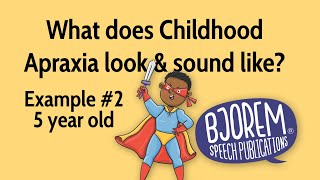 Childhood Apraxia of Speech  Example 2 [upl. by Deer735]