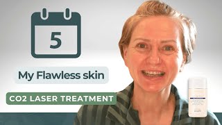 5 Days to FLAWLESS Skin with CO2 Laser Treatment [upl. by Lliw]