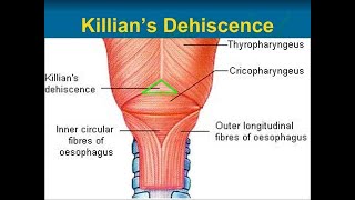 Anatomy of the Killians dehiscence  Pharyngeal dimple  Killians triangle  Killian laimers [upl. by Cullin]