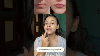 How to get Bigger Lips 👄 Naturally faceexercise shorts lips [upl. by Niwde798]