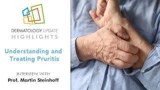 Understanding and Treating Pruritus  Dermatology Update 2016 [upl. by Darton372]