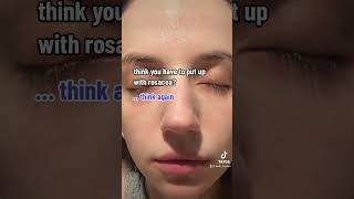 Watch this genius rosacea treatment [upl. by Iyre]