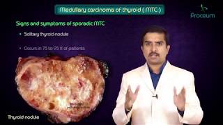 Thyroid neoplasms part 3  Medullary carcinoma of thyroid   Endocrine pathology [upl. by Anselma]