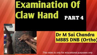 Examination Of Claw Hand [upl. by Eniamsaj135]