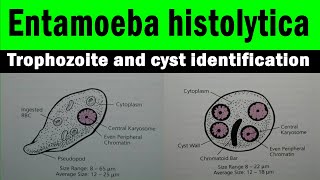 Entamoeba histolytica trophozoite and cyst  microscopic view with identification features [upl. by Haeckel50]