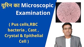 How To Do Microscopic Examination of Urine  Urine microscopy Explained  Pus cells  Rbc [upl. by Sadye678]