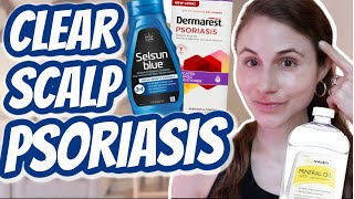 How to CLEAR SCALP PSORIASIS Dr Dray [upl. by Hseyaj]