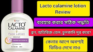 Lacto calamine face lotion reviewLacto calamine face lotion review in Bengali [upl. by Dorman738]