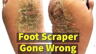 Foot Scraper Gone Wrong [upl. by Llecram]