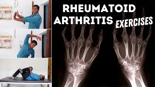 7 Best Rheumatoid Arthritis Exercises for Hand amp Leg [upl. by Brey]