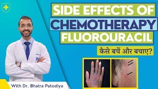 Fluorouracil  Side Effects Of Chemotherapy  Avoid With Easy 7 Steps  Dr Bharat Patodiya [upl. by Ydoj]