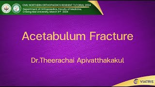 Acetabulum Fracture [upl. by Nnylylloh413]