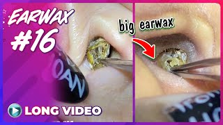 EP 16 Earwax ASMR Whats in ears that havent been cleaned for a long time [upl. by Iaoh]