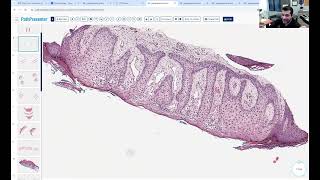 Avi Bitterman Dermpath Lecture 1 [upl. by Cale855]