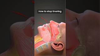 How to stop Snoring ↪ 3D Medical Animation Shorts StopSnoring Sleep Snoring [upl. by Annatnas]