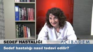 Sedef hastalığı nasıl tedavi edilir [upl. by Streeter155]