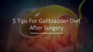 Foods and Drinks to Avoid After Gallbladder Removal [upl. by Graehl]