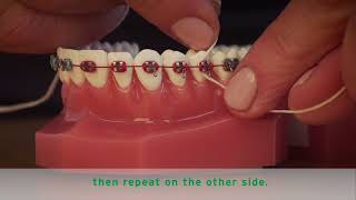 HOW TO FLOSS BRACES [upl. by Najed115]