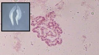 Identifying characters of polytene chromosome of Drosophila sp [upl. by Sabec108]