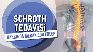 Schroth Nedir Schroth Egzersizleri Kimlere Uygulanır Schroth Tedavisi Hakkında Merak Edilenler [upl. by Silsbye]