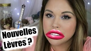 Chirurgie esthétique MES INJECTIONS AUX LÈVRES Mon expérience [upl. by Oremar753]