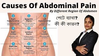 Abdominal Pain In Bengali  Differential Diagnosis Of Abdominal Pain  Types  Causes  Areas [upl. by Mildred]