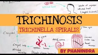 TRICHINOSIS  TRICHINELLA SPIRALIS  STRUCTURE  LIFE CYCLE  SYMPTOMS  BY PHANINDRA GUPTA [upl. by Sidnarb829]