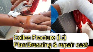 Colles Fracture LtPlanDressing amp repair castOur Treatment [upl. by Nuj]