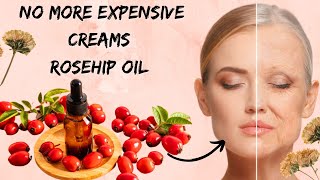 Amazing Benefits Of Rosehip Oil Rosehip Oil Uses On Skin and Hairs [upl. by Ecnarf]