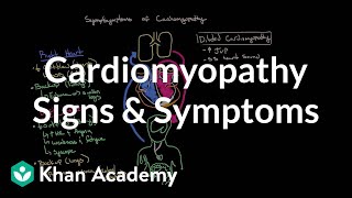 Cardiomyopathy signs and symptoms  Circulatory System and Disease  NCLEXRN  Khan Academy [upl. by Sonnie452]