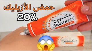 تجربتي مع كريم سكينورين لتفتيح البشره 🤩  skinoren cream  كريم لإزالة الكلف و تبييض الوجه [upl. by Kile]