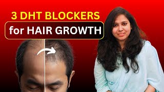 3 DHT blocker supplements in Telugu  Dr Deepthi  Crowns Clinic [upl. by Elac]