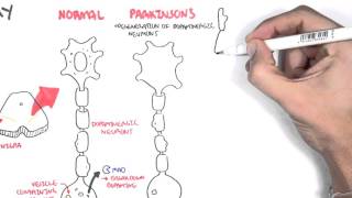 Pharmacology  Parkinsons Disease [upl. by Filip142]