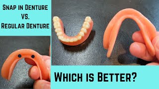 Why a lower snap in denture is better than a lower regular denture [upl. by Paehpos]